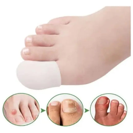 Par Protector De Silicona Ortopédico Dedo Del Pie Funda #1 Blanco